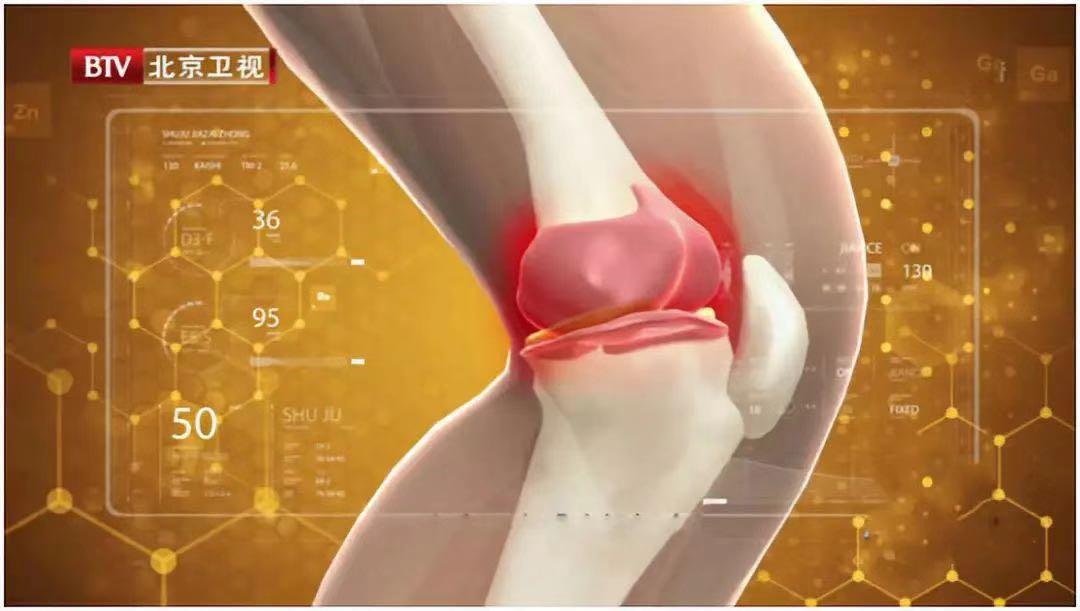 风湿性老寒腿怎么治疗,老寒腿是不是风湿性关节炎