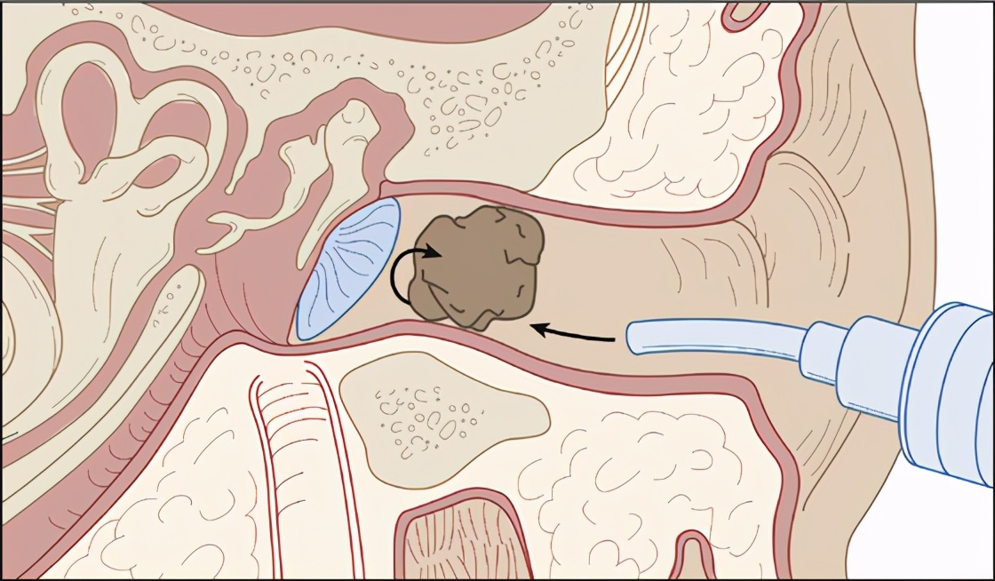 蟑螂为什么喜欢在插座底下下崽,蟑螂为什么喜欢钻入耳朵