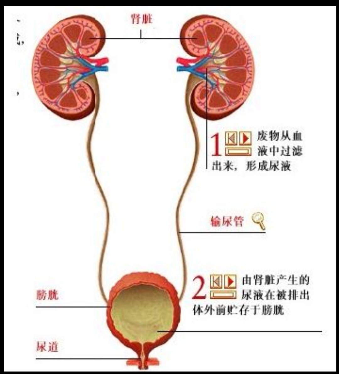 马桶尿液中有泡沫啥问题,吃恩格列净为什么尿液出现泡沫