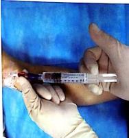 PICC冲封管不到位?来看看问题出在哪里吧