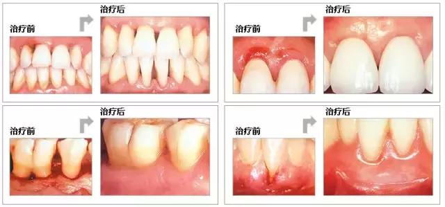 helen鐗欑,Helen榻跨涓績
