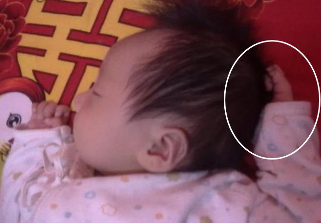 刚出生的孩子被医生打了怎么办,新生儿被打了吓到了对他有影响吗