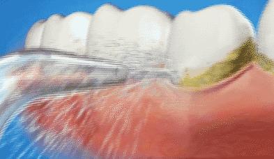 一张嘴就臭,一张嘴就口臭小妙招