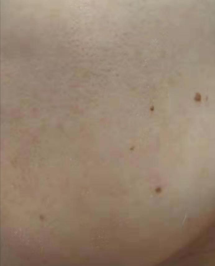 敏感肌适合的洗面奶乳液,适合红血丝皮肤的乳液