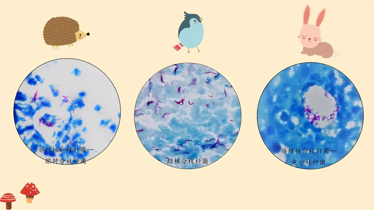 病理科神秘面纱,揭开病理的神秘面纱