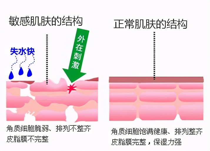 唇周黑敏感紧绷干燥起皮怎么办,脸起皮干燥紧绷刺痛发红用什么药