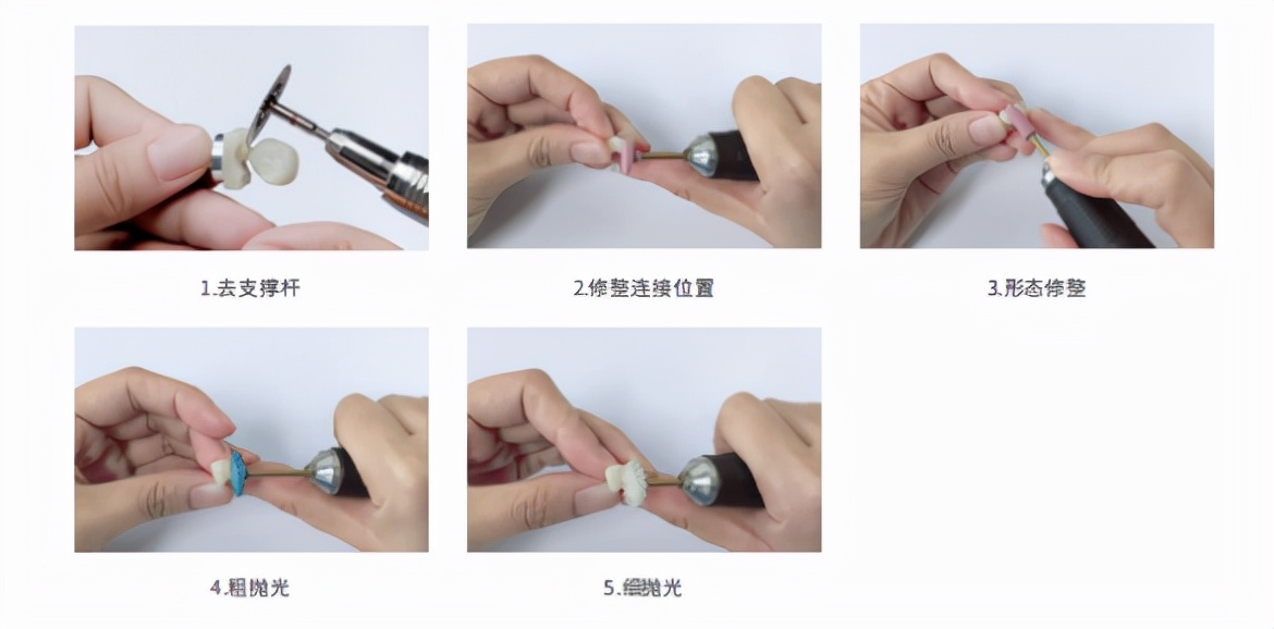 椅子修复工艺视频,椅旁修复技术安全性