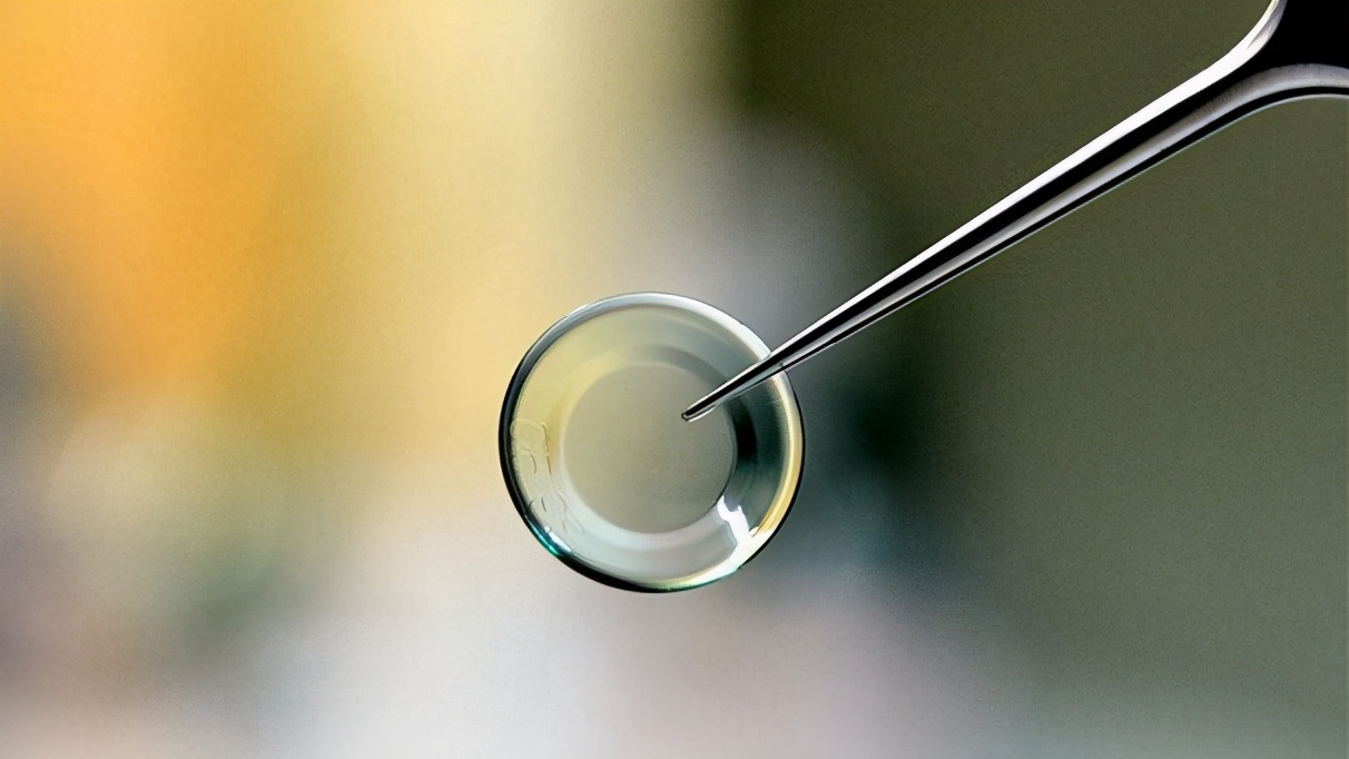 粘多糖贮积症1岁宝宝,黏多糖贮积症多少岁看出来的