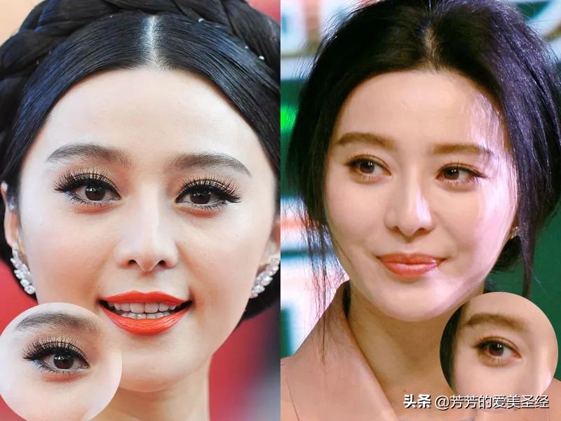 眼睛变大的方法用五天,眼睛变大有方法吗