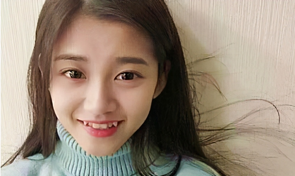 为什么有些人会长獠牙,为什么有的人成年了还会长牙