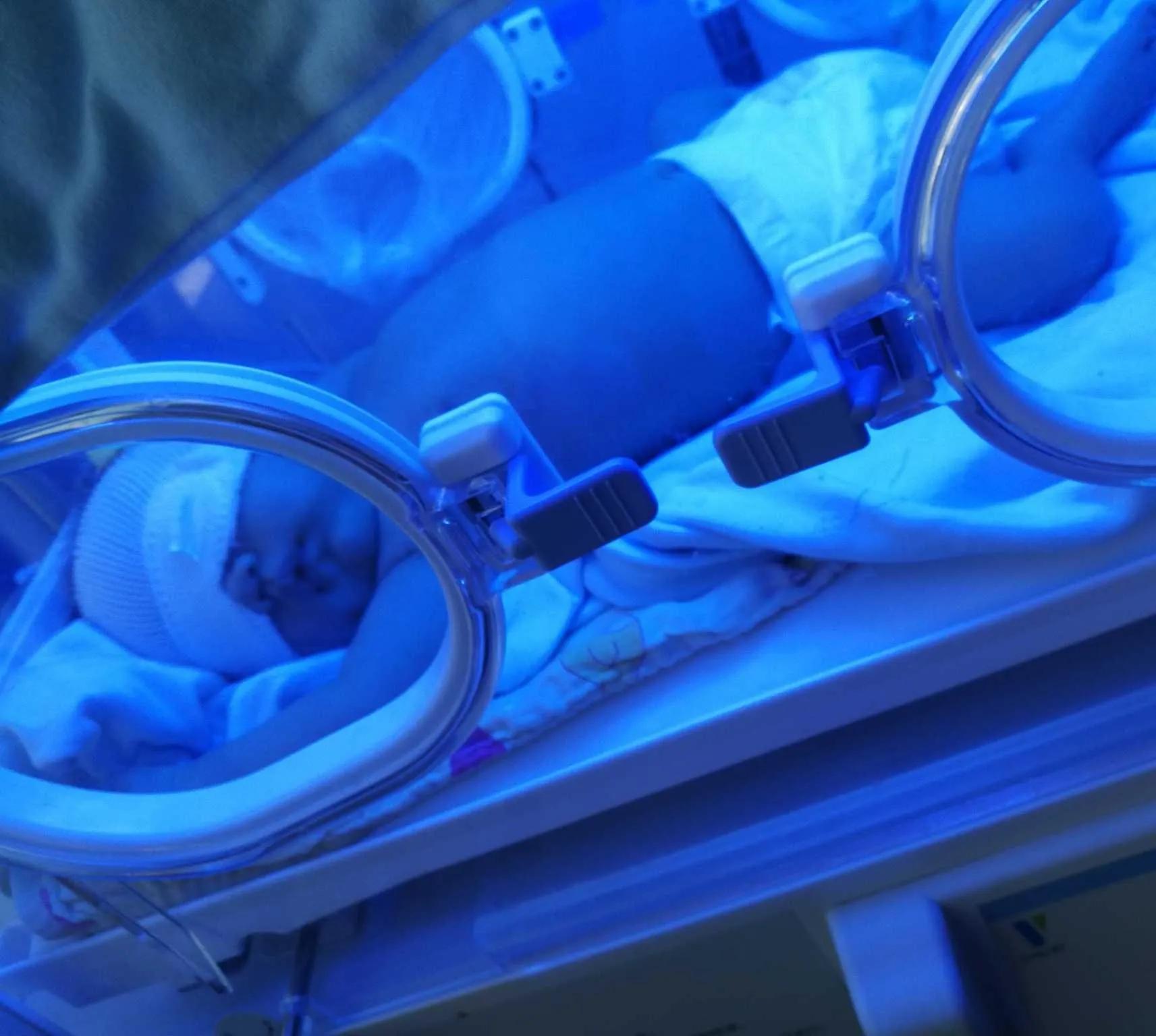 宝宝照蓝光黄疸下降能强制出院吗,宝宝照蓝光退了皮肤就不黄了吗