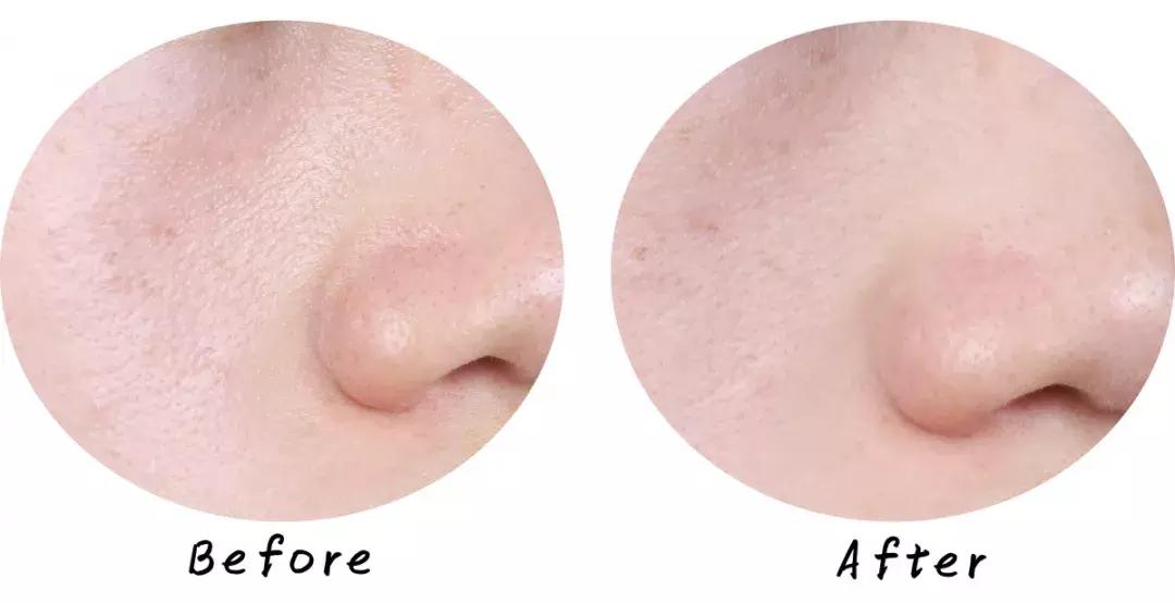 swisse麦卢卡蜂蜜排毒清洁面膜,超温和清洁面膜推荐哪个