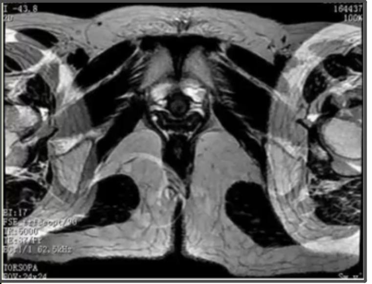 脊柱mr扫描规范,MR扫描各序列特点