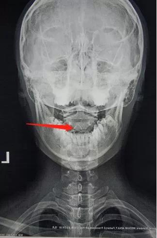 颈椎腰腿痛治疗手法,老中医治疗颈椎腰腿疼