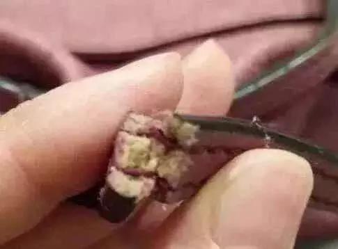 lv包为什么瑕疵这么多,10年不褪色的lv包是真的吗