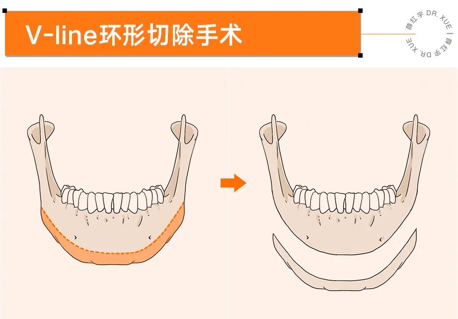 下巴宽厚的人,头尖下巴宽厚