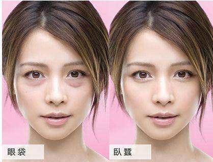 祛眼袋没有卧蚕了,没有卧蚕明星
