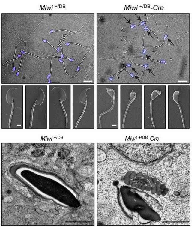 精子质量检测深度学习,精子质量检测怎么做