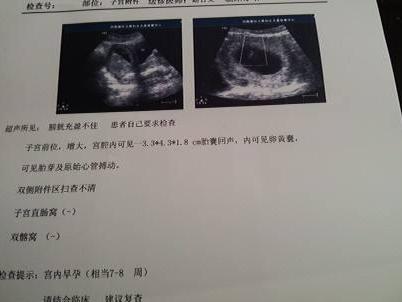 想要小棉袄,想要小棉袄的原因