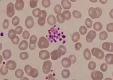 关于“检验报告”，这大概是最科学的一篇文章了