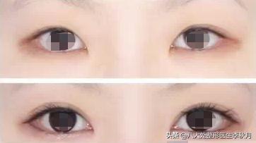 哪些男女明星双眼皮是割的,娱乐圈双眼皮男明星