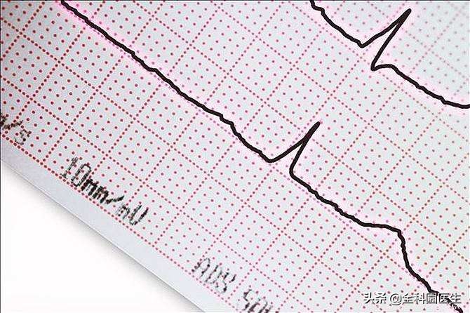 健康体检一般检查哪些项目多少钱,老年人健康体检必须检查的项目是