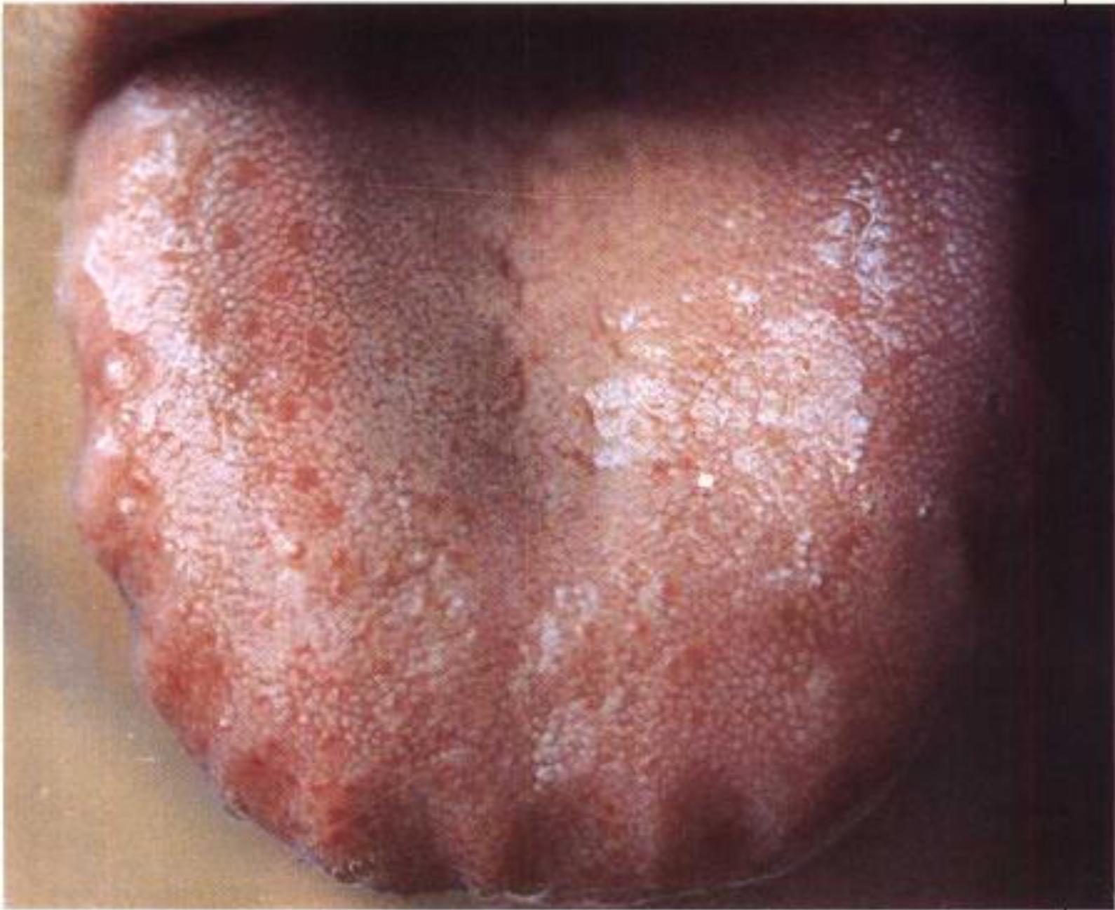 如何从舌苔判断健康,怎样通过舌苔颜色判断身体状况