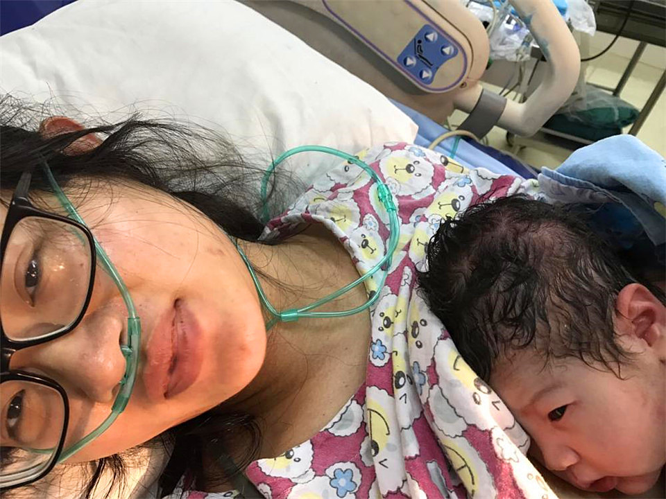 顺产分娩的痛苦,顺产疼痛的5个明显细节