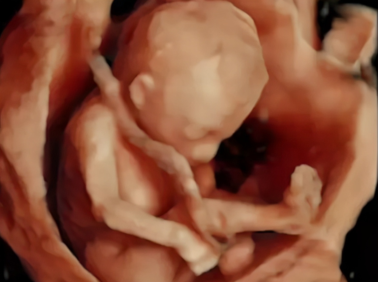 胎儿在羊水里耳朵会进水吗,胎儿在羊水中会被羊水淹没吗