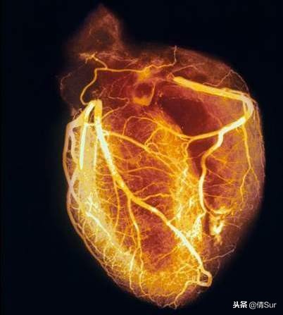 心源性猝死马拉松,马拉松心脏猝死的抢救