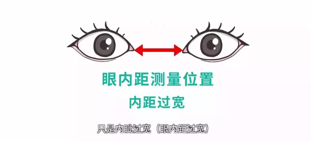 3秒辨别孩子是不是斗鸡眼,怎么判断小孩斗鸡眼