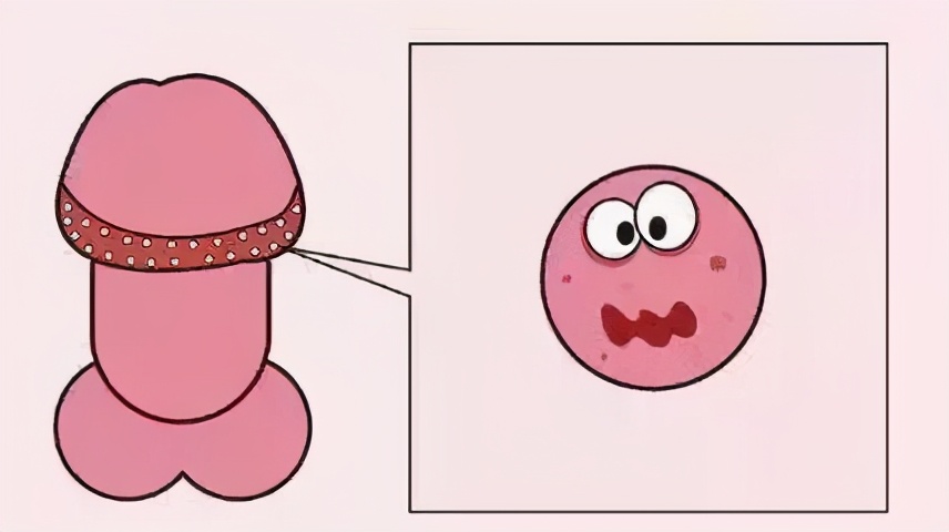 丁丁上怎么长了“小疙瘩、小红点”？难道是染上了性病？