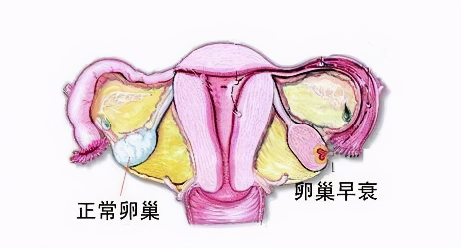 保护子宫健身运动,保护子宫瑜伽姿势