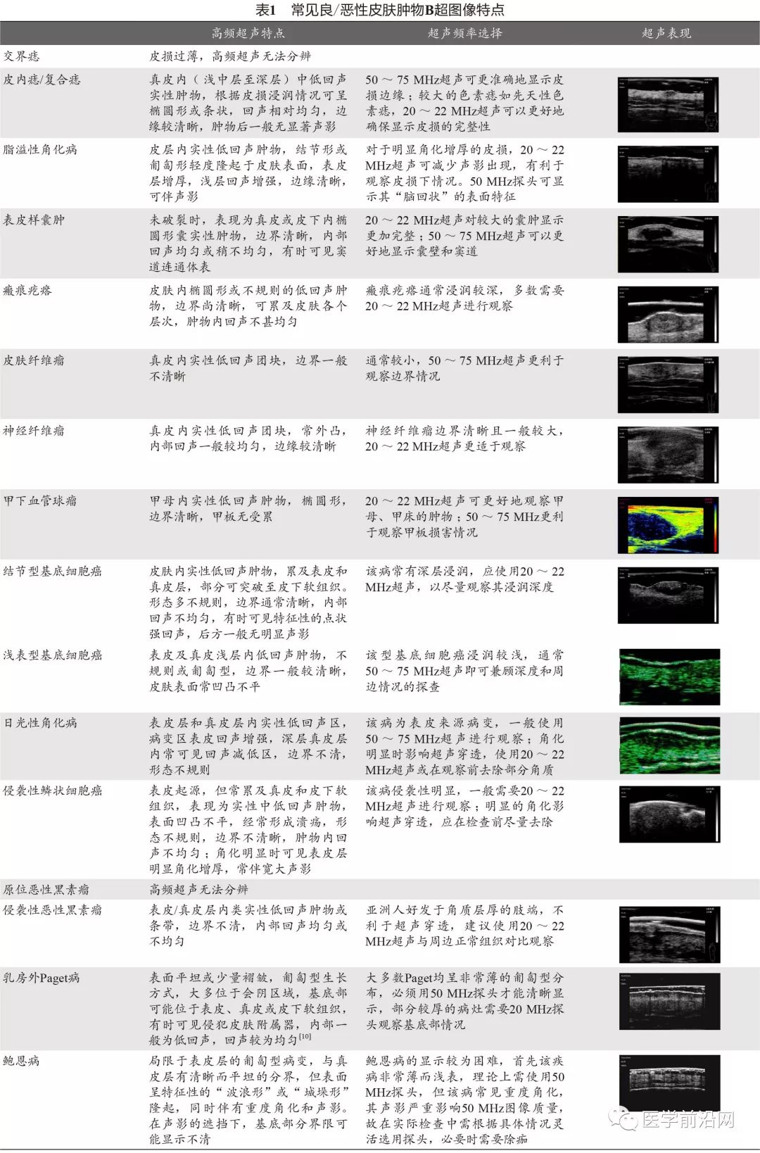常见皮肤病高频皮肤超声诊断专家共识全文发布