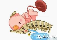 孕期大腿痛跟坐骨神经有关吗,孕期右侧坐骨神经痛哪侧睡觉