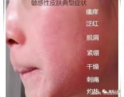 内外兼修的修护精华,内外兼修的精华修复补水