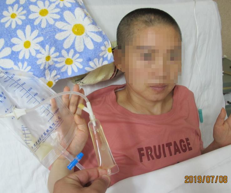 脑出血后脑积水会造成意识不清吗,脑出血后脑积水发高烧危险期多久