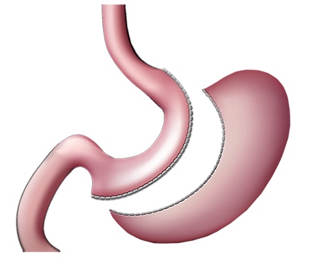 胃萎缩性糜烂胃炎能痊愈吗,萎缩性胃炎胃溃疡中药能治好吗