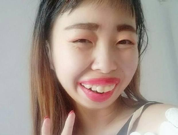 孩子门牙掉了恒牙位置不正怎么办,小孩牙长歪了能不能不矫正