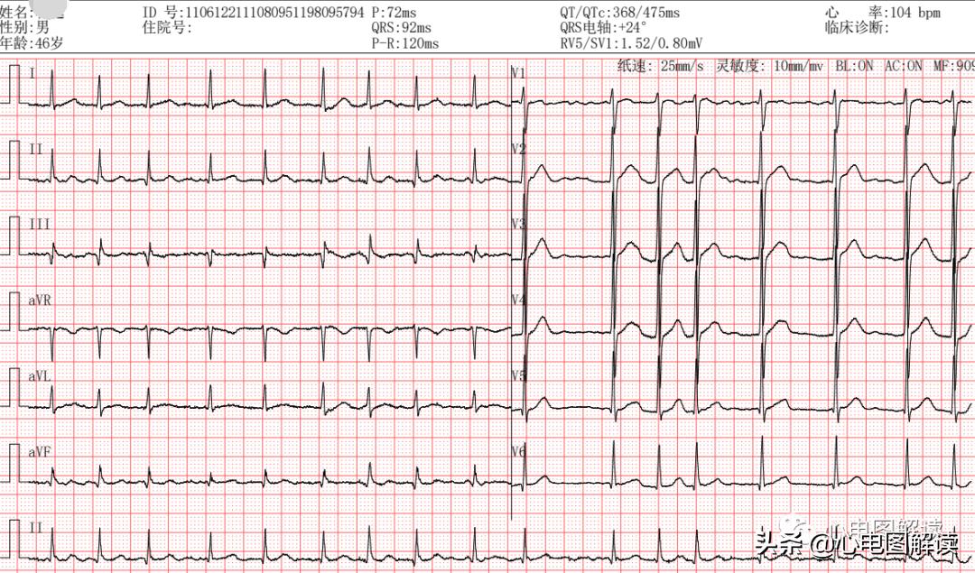 自医自治,最新心房颤动诊疗指南