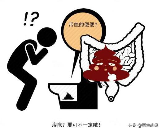 大便擦不干净是肠癌吗,上大号老是感觉排不干净擦不干净