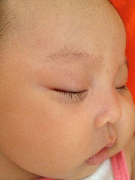 宝宝长期调理脾胃为什么脸色还黄,脾胃虚脾胃消化弱脸上有什么表现