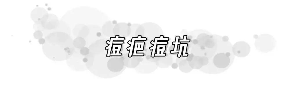 痘印反反复复怎么办,痘印一直反反复复怎么办