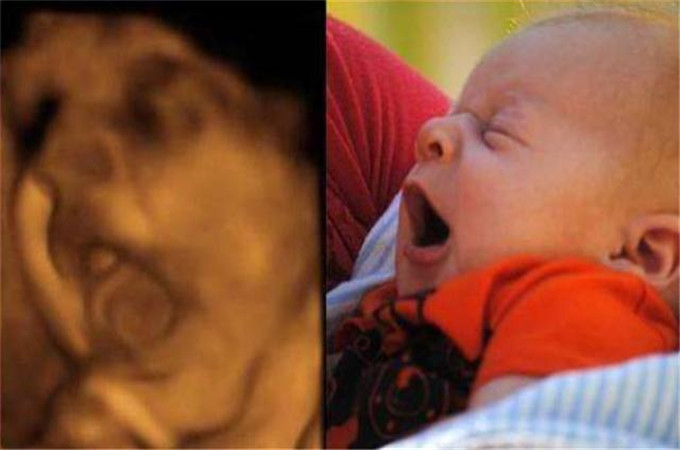 宝宝四维照片和生下来照片对比,四维照片所有宝宝都长得一样吗