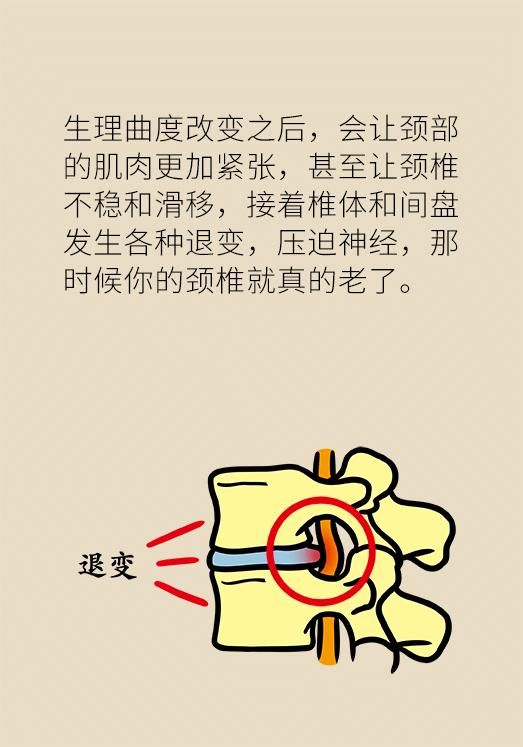 二十岁的年龄，六十岁的颈椎，快试试协和专家的颈椎保健操！