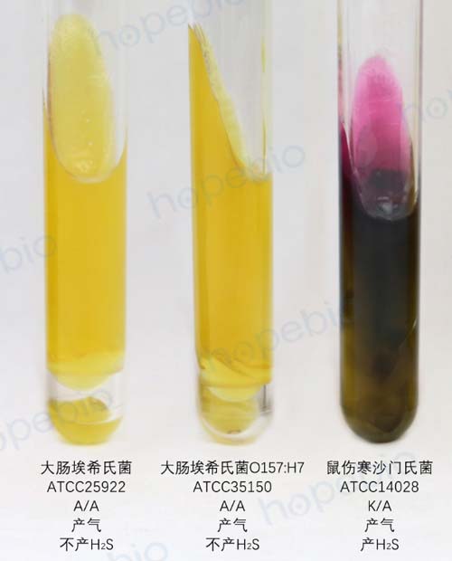 大肠埃希菌培养,大肠埃希菌70%正常吗