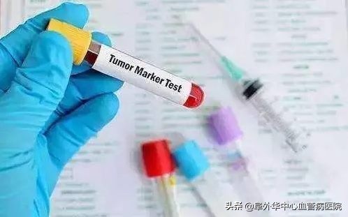 肿瘤标志物升高你是不是被吓到了,肿瘤标志物ca125单项升高意义不大