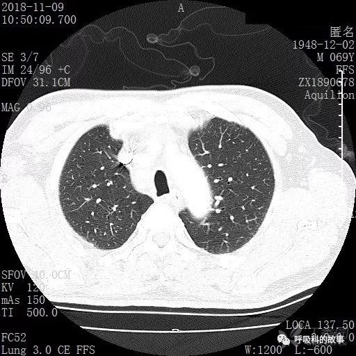 怎么应用统计学做调查,统计学方法可以解决的主要问题