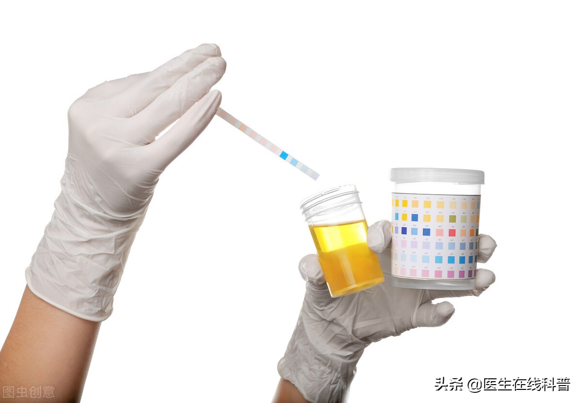 事业编体检尿潜血2+怎么办,体检报告上尿潜血1+怎么回事