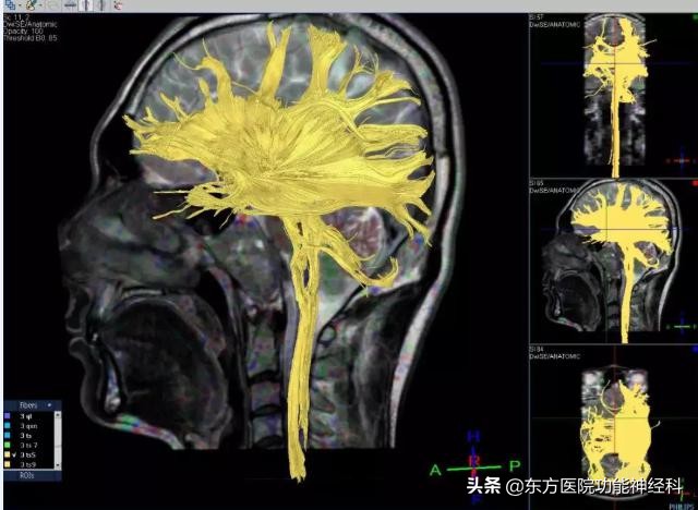 精神病反复住院几十次,精神病反反复复复发